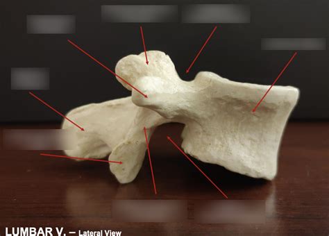 Back Lumbar Vertebrae Lateral View Diagram Quizlet