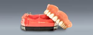 Implant Retained Dentures Calgary Denture Specialist