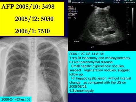 Gi Radiology Case 1 陳x貞 45 Year Old Female Ppt Download