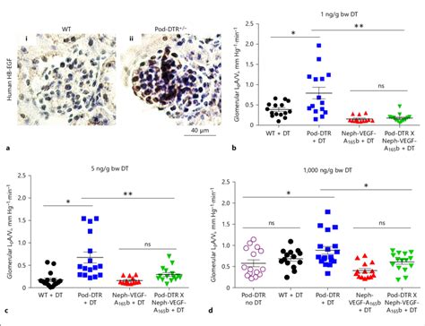 Podocyte Specific Expression Of Human Diphtheria Toxin Receptor Hdtr