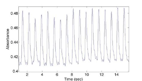 50 Hz Notch Filter Output Download Scientific Diagram