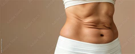 Sagging Abdominal Skin After Weight Loss Close Up Of Abdomen With Fat Folds Banner For Plastic