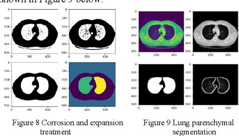 Figure 1 From Lung Nodule Detection Method Based On Improved YOLOv4