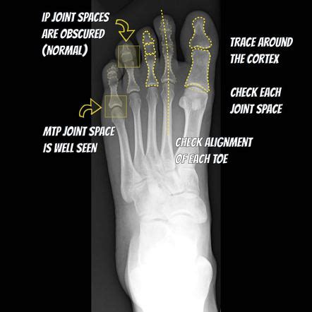 Foot Xray Anatomy Anatomical Charts Posters