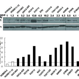 Fbi Expression Was Up Regulated In Most Of The Ovarian Cancer Cell