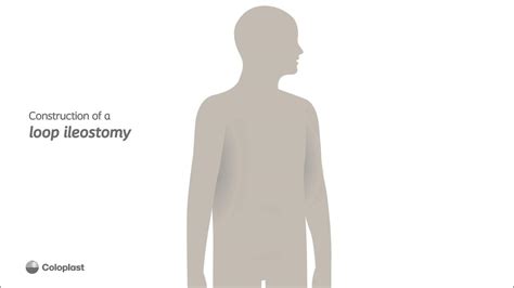 Anatomy Of Loop Ileostomy Construction Youtube