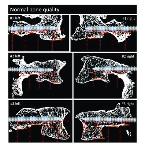 Parasagittal Reconstruction Of The Micro Ct Scans Of The Vertebrae With Download Scientific