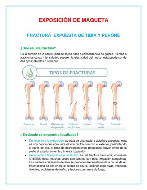 Fracturas EXPOSICIÓN DE MAQUETA FRACTURA EXPUESTA DE TIBIA Y PERONÉ