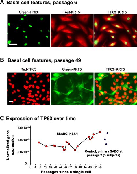 Characterization Of An Immortalized Human Small Airway Basal Stem