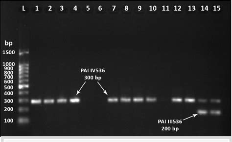 Ethidium Bromide Stained Agarose Gel Of Multiplex Pcr A Amplified