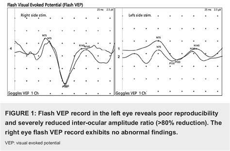 Figure 1 From Severe Paradoxical Manifestations In An Immunocompetent