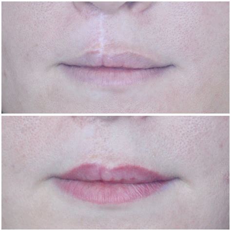 Permanent Make Up Lippen M Nchen Bei Design Pigmente Permanent Make