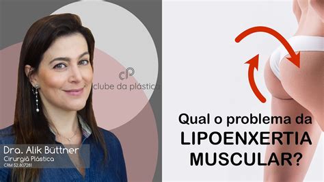 Clube da Plástica qual o problema da lipoenxertia muscular YouTube