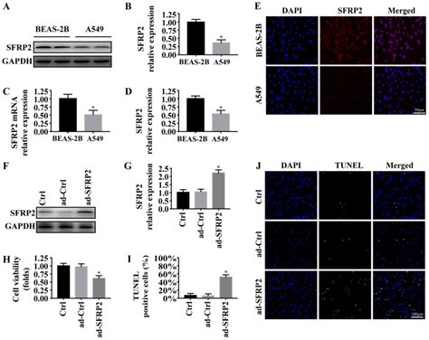 Sfrp2 Modulates Non‑small Cell Lung Cancer A549 Cell Apoptosis And