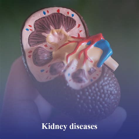 Kidney Disease - AQUAVITA