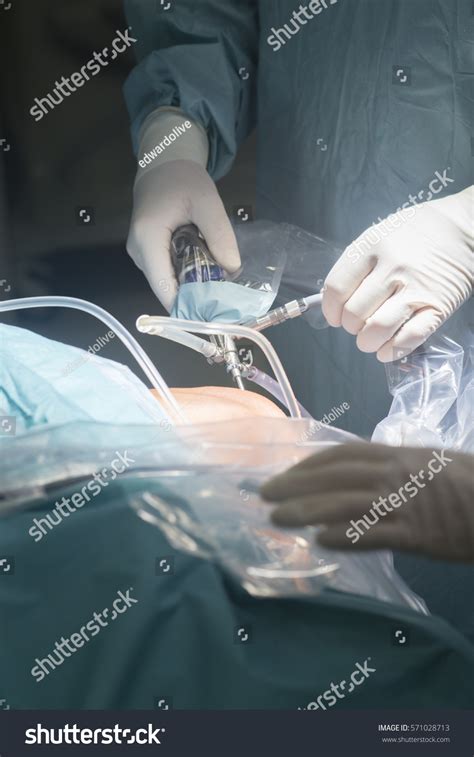 Knee Keyhole Surgery Hospital Arthroscopy Operation Stock Photo 571028713 | Shutterstock