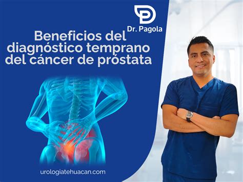 Diagnóstico Temprano Del Cáncer De Próstata Urología Tehuacán