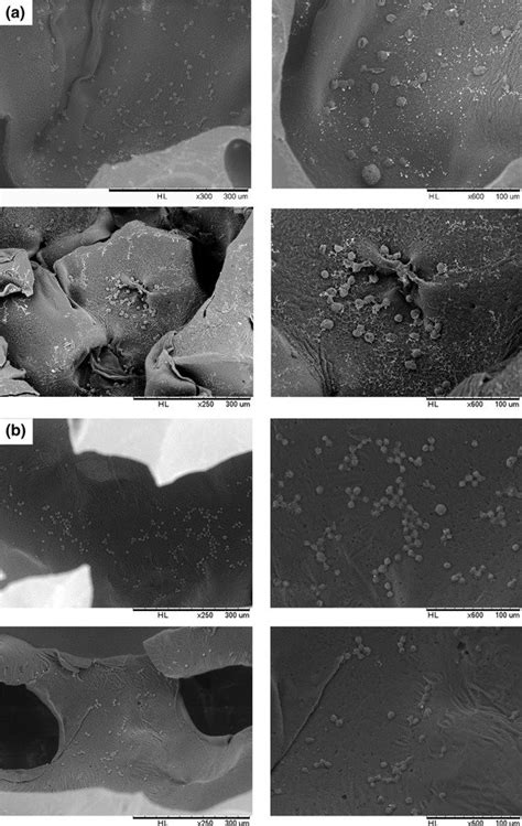 Scanning Electron Micrographs Of Mg63 Cells At A 12 H And B 1 Days Of Download Scientific