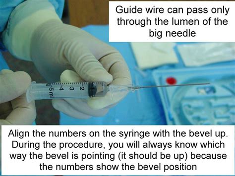 Clinical Notes Central Line Placement A Step By Step Procedure Guide With Photos