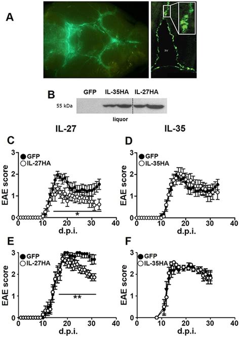 Il But Not Il Gene Therapy Inhibits Clinical Eae Development