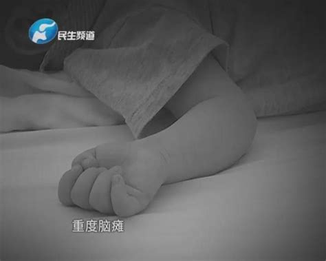 从尸袋救出七个月早产儿，竟“死而复生”，医院有责任吗？ 哔哩哔哩