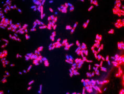 Microbiologia Y Parasitologia 2e Unpa Echerichia Coli Enterohemorragica