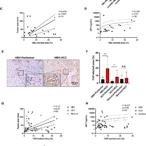 Hbx And Yap Protein Expression In Hcc Progression A Representative Download Scientific