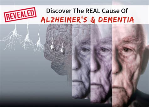 Revealed Discover The Real Cause Of Alzheimers Dementia