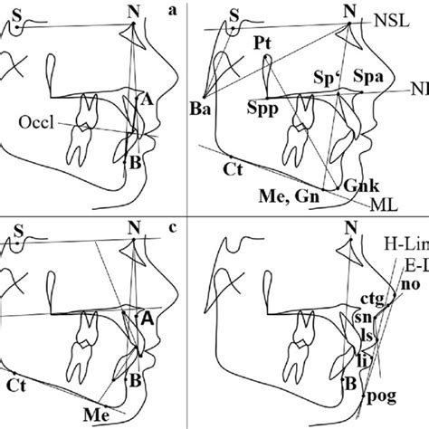 A D Relevant Cephalometric Variables Analysed A Sagittal Skeletal Download Scientific Diagram