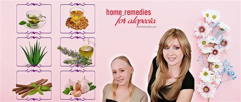 30 Ancient Proven Natural Home Remedies For Alopecia Areata