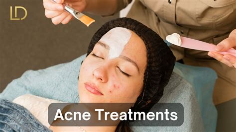 A Comprehensive Guide To Addressing Acne Scars Unveiling The Best