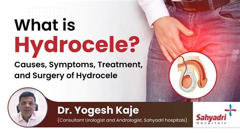 What Is Hydrocele Causes Symptoms Treatment And Surgery Of