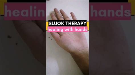 Shorts Sujok Therapy Youtube