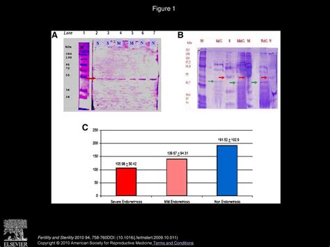 Growth Differentiation Factor Concentration In The Follicular Fluid