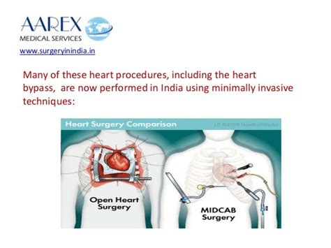 Open Heart Surgery Vs Minimally Invasive Cardiac Bypass Surgery