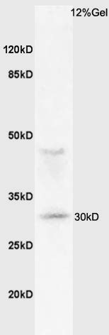 Rabbit anti MHC Class II Polyclonal Antibody Absin 优宁维 univ 商城