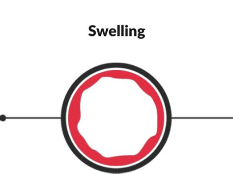 What Is Eosinophilic Esophagitis Eoe Including Symptoms Causes