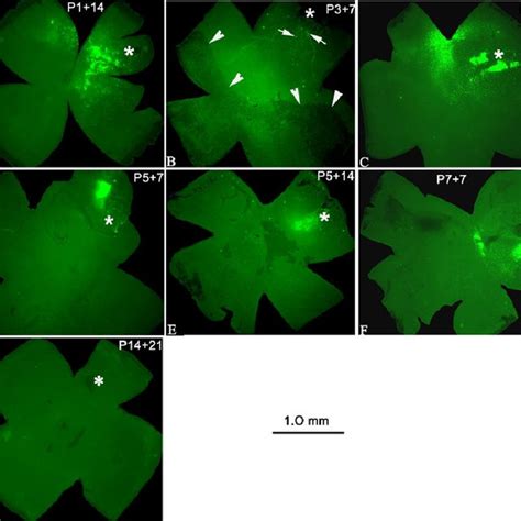 Gfp Expression In Retinal Cells After Subretinal Injection In Rd Mice