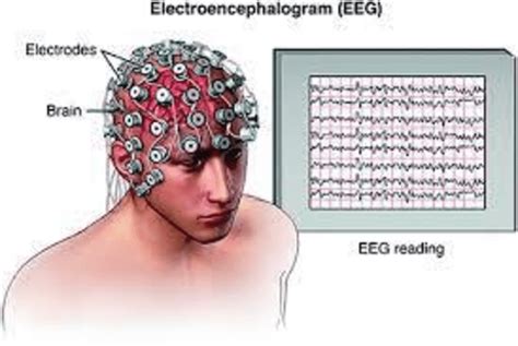 Procedure Of Eeg Recording 6 These Eeg Signals Are Used In The