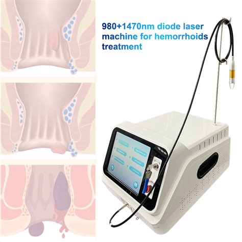 Rectal Surgery Endolaser Dual 980 1470 Fistula Treatment Hemorrhoid