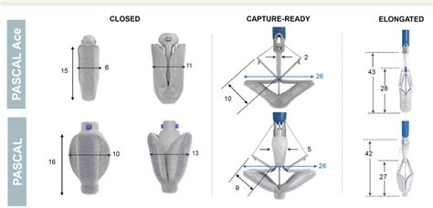 Figure 1 From State Of The Art Intra Procedural Imaging For The Mitral