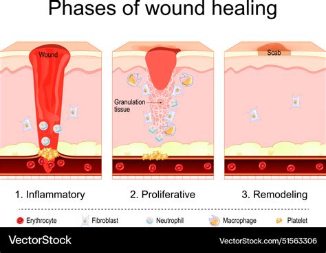 Wound healing process tissue repair Royalty Free Vector