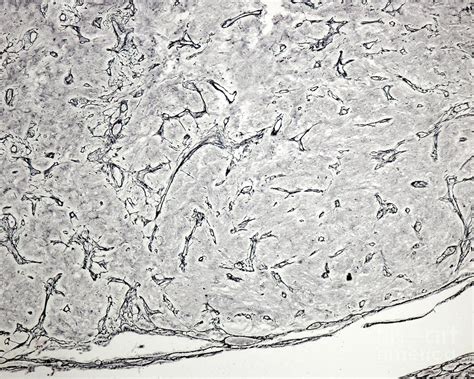 Reticular Fibres In Human Pituitary Gland Photograph By Jose Calvo