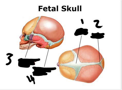 Fetal Skull Diagram Quizlet