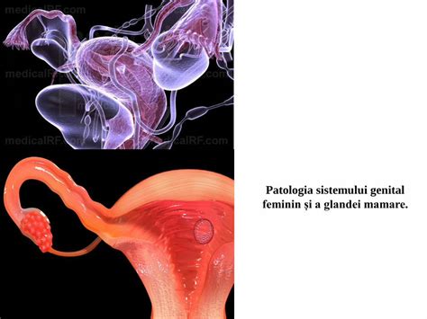 PDF Patologia sistemului genital feminin și a glandei mamare