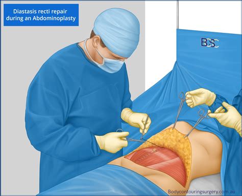 Different Types of Abdominoplasty Surgery for Your Unique Body Concern