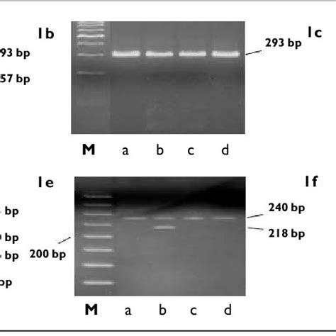 Gel Electrophoresis Profile Of The Detection Of Beta Thalassaemia Download Scientific Diagram