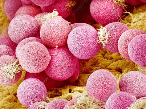 Primrose Pollen SEM Stock Image B786 0914 Science Photo Library