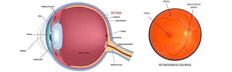 Retina Von Hertwig Cl Nica E Hospital De Olhos