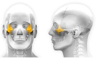 Implants Zygomatiques Sur Rodez Avantages Tarifs Intervention